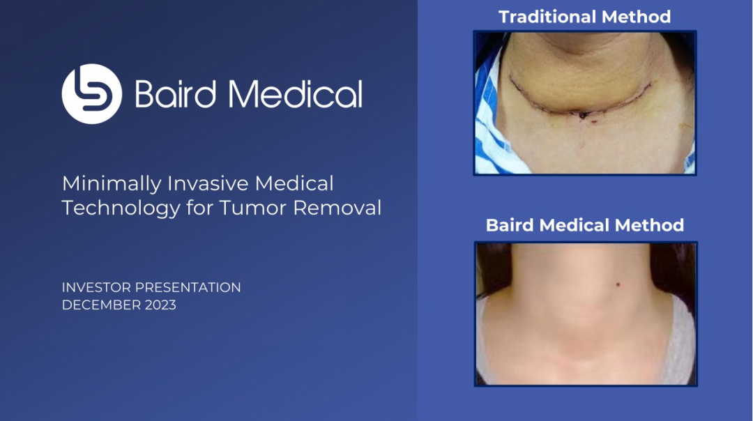 1704878798846133.png 5064833ae073b9b01d63c0c656f878c7_640_wx_fmt=png&from=appmsg&wxfrom=5&wx_lazy=1&wx_co=1.png