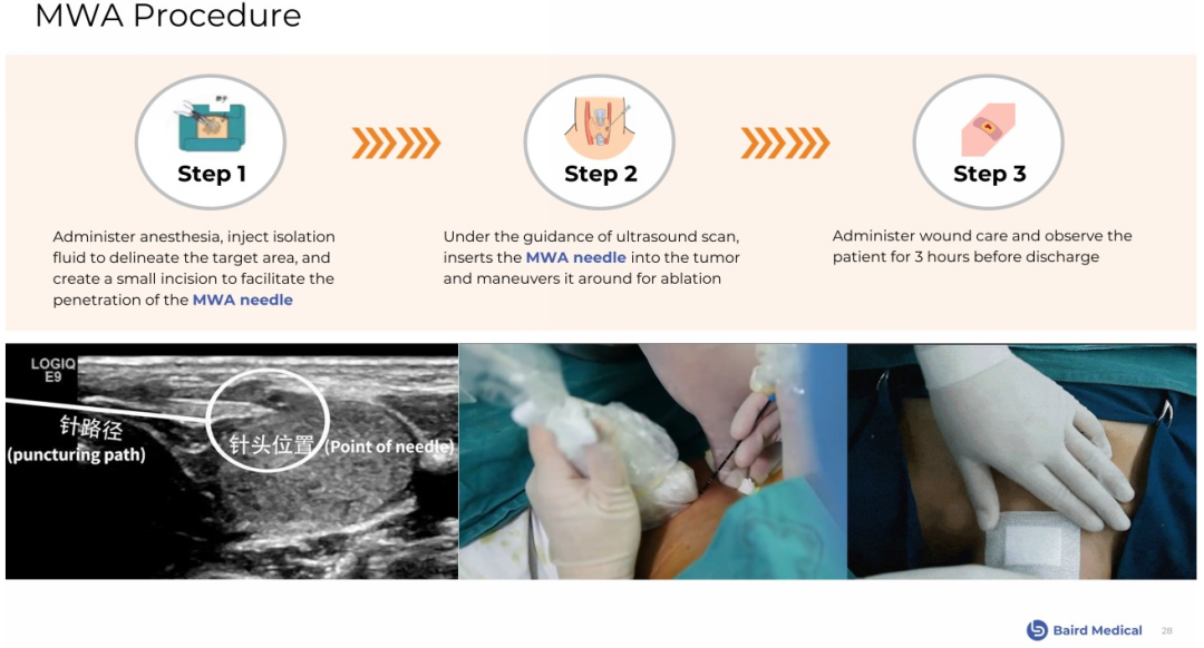 1704878960927765.png c457c8a417593658e6adc77305a1f4de_640_wx_fmt=png&from=appmsg&wxfrom=5&wx_lazy=1&wx_co=1.png